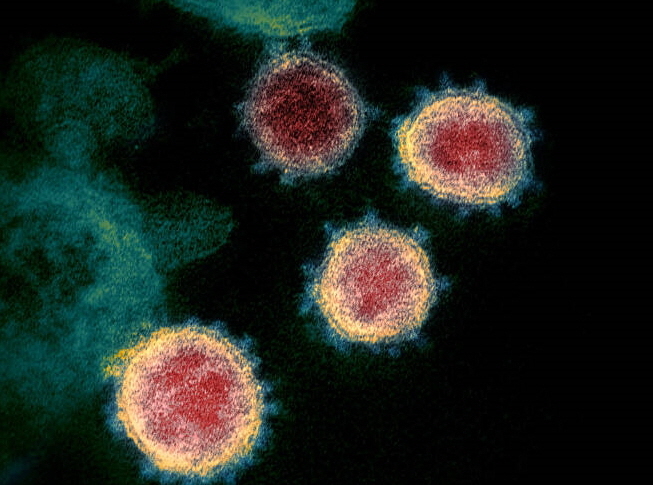 ,           '코로나19 바이러스' 전자 현미경 촬영 사진 (자료: NIAID)